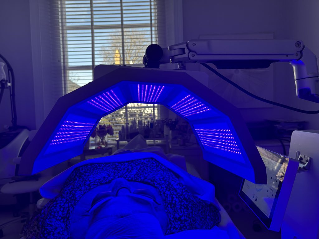 Blue Light Treatments