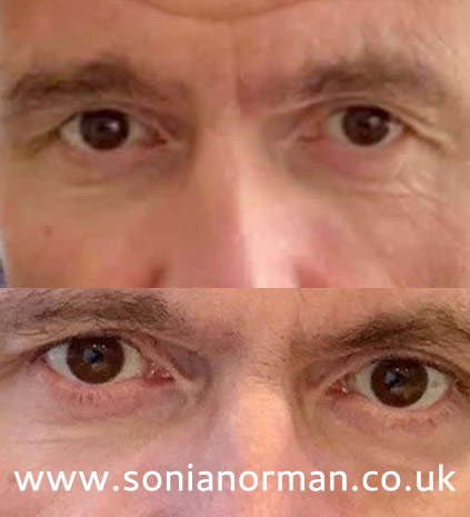 Daryl Eyes watermark