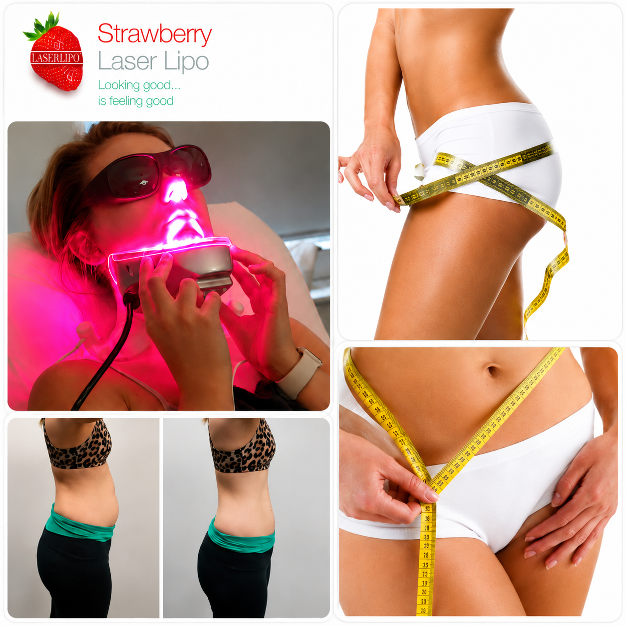 Strawberry Lift HIFU and laser lipo treatment in Cheltenham
