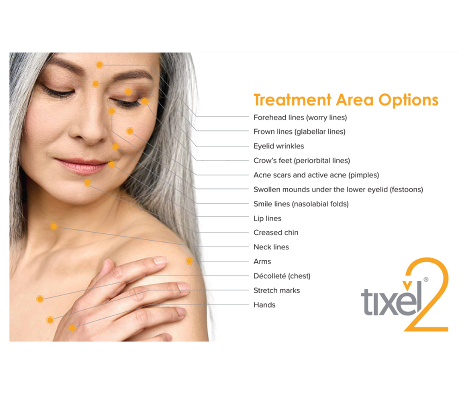 Tixel 2 offers transformative results across multiple treatment zones