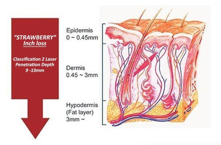 Strawberry Laser Lipo inch loss illustration